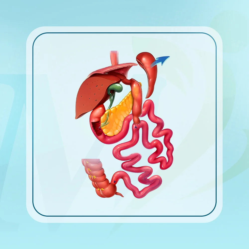 عملية الساسي