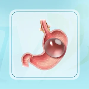 الكبسولة المبرمجة