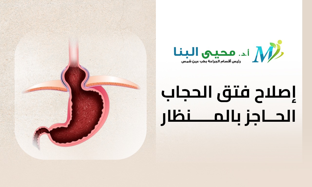 إصلاح فتق الحجاب الحاجز بالمنظار