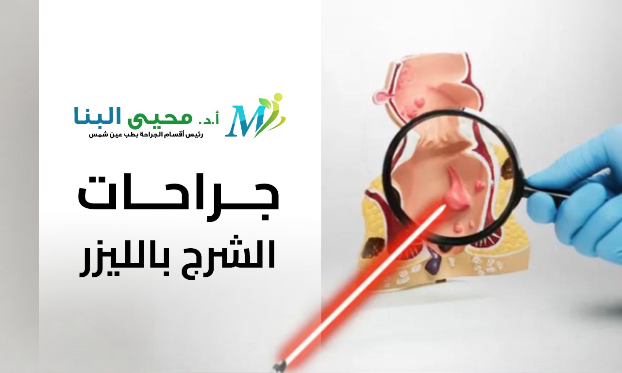 جراحات الشرج بالليزر