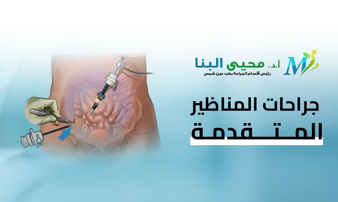 جراحات المناظير المتقدمة