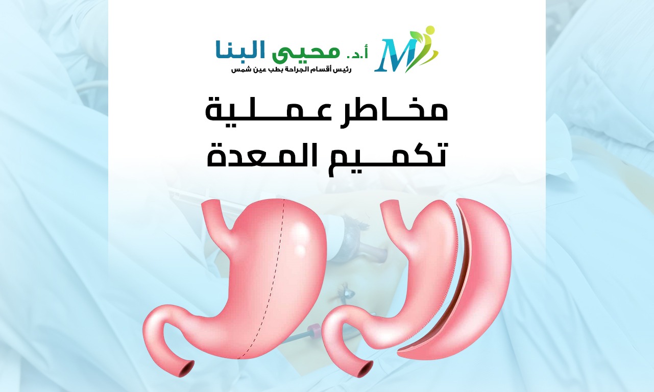 مخاطر عملية تكميم المعدة